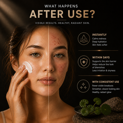 Rivora Skin Cream