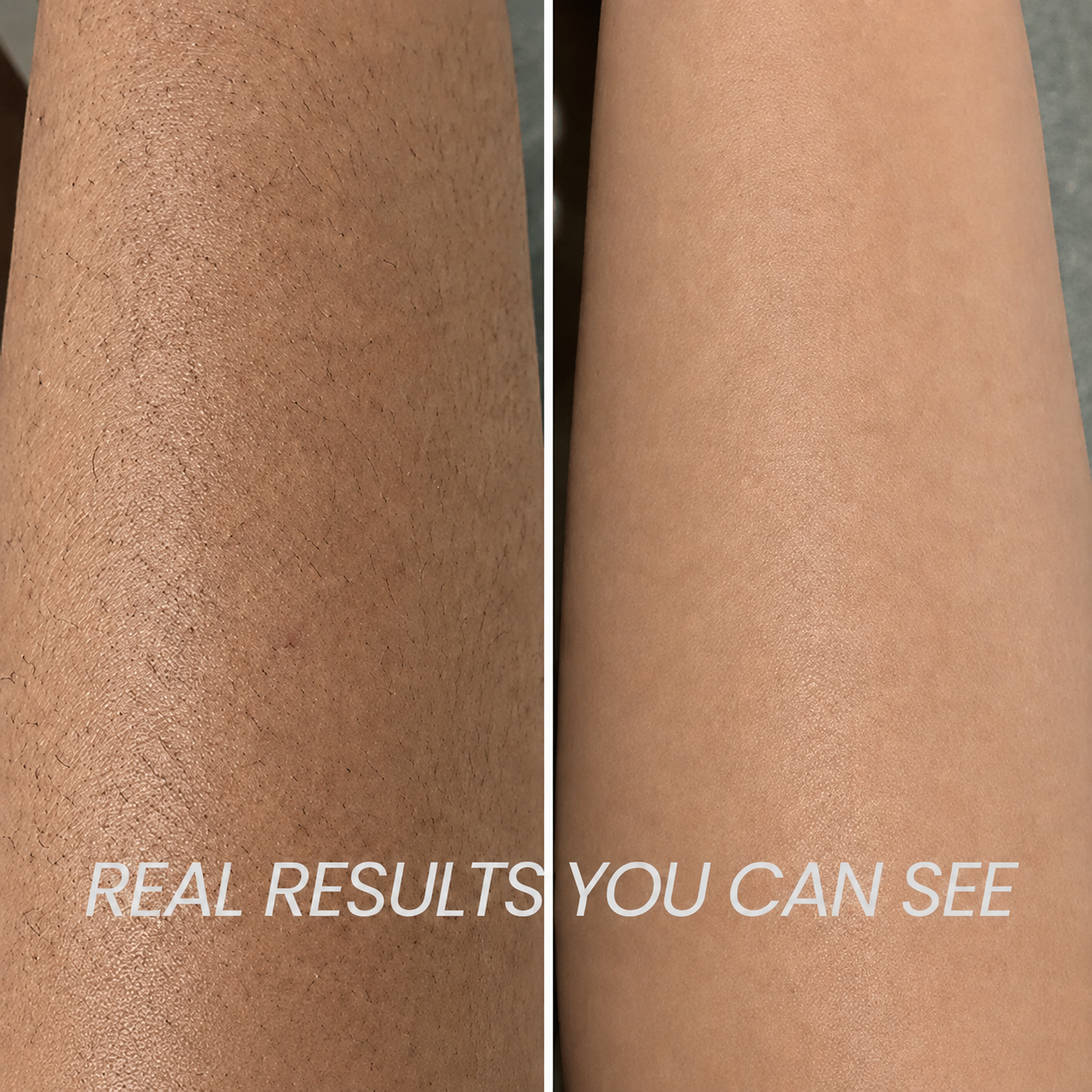 Hair Reduction Oil