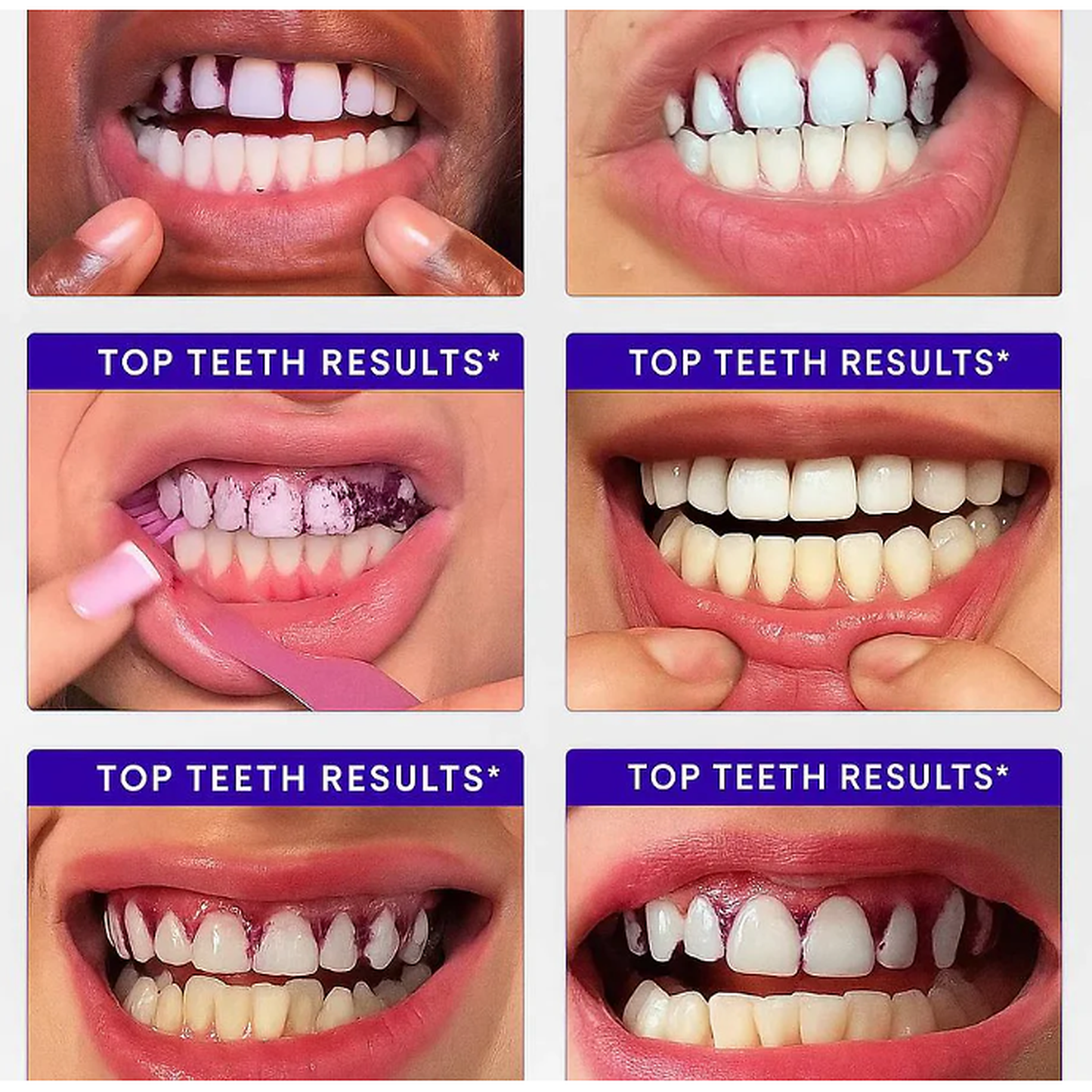 Whitening Strips